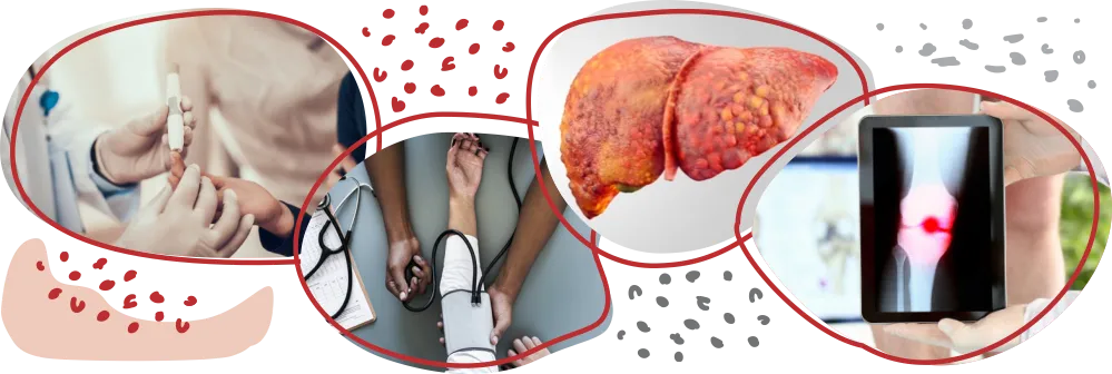 Ilustración de las consecuencias más frecuentes de la obesidad.