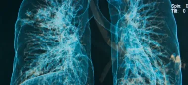 Imagen complementaria de Neumonología.